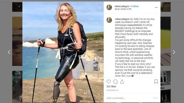 Rebecca Legon, wanita disabilitas asal Inggris yang kini bisa menerima keadaan dirinya