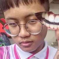 Jika kamu nggak punya uang untuk pergi ke dokter gigi, atasi dengan cara yang satu ini.