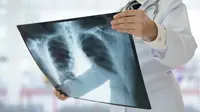 Perlu diketahui gejala utama pasien TBC paru, yaitu batuk berdahak selama dua minggu atau lebih.
