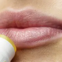 Kandungan shea butter membuatnya bisa jadi lipbalm alami yang ampuh atasi bibir kering. (Foto: pixabay.com)