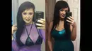 Jasmine Tridevil menabung selama dua tahun sebelum menemukan seorang ahli bedah plastik yang bersedia menjalankan operasi tersebut. (Facebook.com)