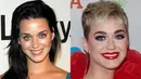 Katy Perry melakukan laser dan filler injection di bawah matanya untuk menghilangkan lingkaran hitam. (Rex/Shutterstock/HollywoodLife)