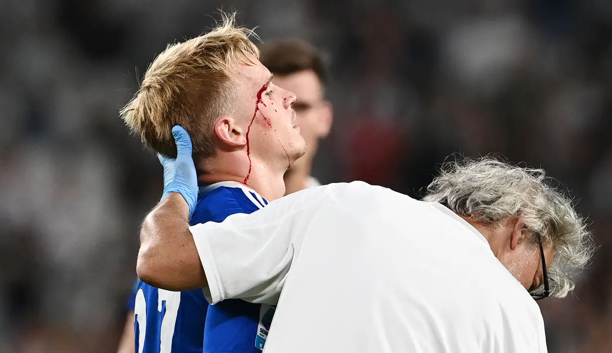 Pemain Como, Matthias Braunoder, mengalami cedera di bagian kepala saat melawan Juventus pada laga Liga Italia di Allianz Stadium, Selasa (20/8/2024). (AFP/Isabella Bonotto)