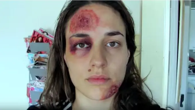 'Selfie' Selama 1 Tahun, Perempuan Ini Hadapi Akhir Mengerikan