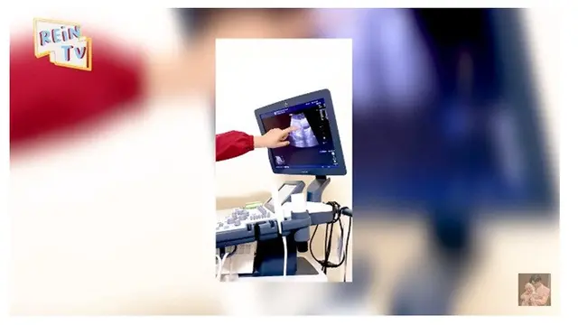 8 Momen Dinda Hauw dan Rey Mbayang Umumkan Kehamilan, Penuh Bahagia