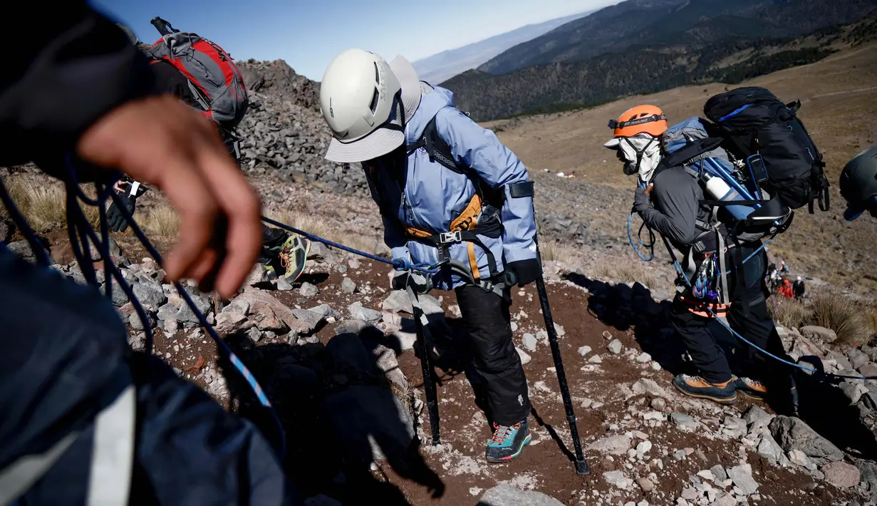 Ximena terpaksa kehilangan satu kakinya akibat penyakit yang diderita. (Rodrigo Oropeza/AFP)