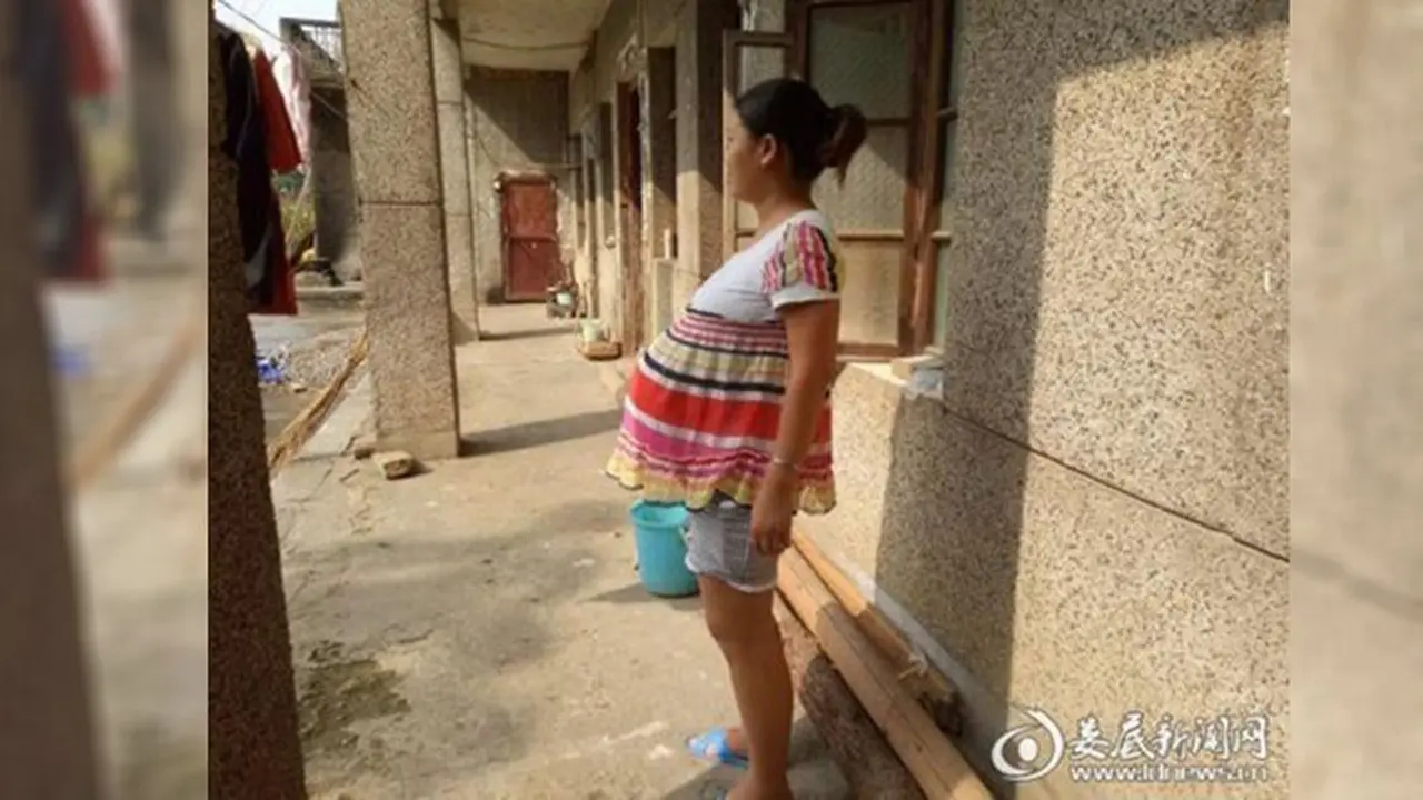 Kondisi Langka, Wanita Hamil 17 Bulan dan Belum Melahirkan