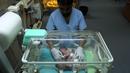 Perawat mengecek kondisi bayi kembar siam berusia satu hari terlihat di dalam inkubator di Rumah Sakit al-Shifa di Kota Gaza, (22/10). Kepala rumah sakit al-Shifa mengatakan bayi ini akan dibawa ke luar negeri untuk dipisahkan. (AFP Photo/Mahmud Hams)