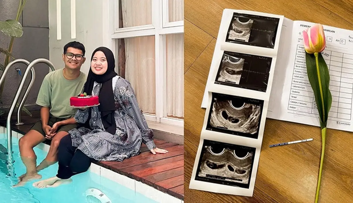 Musdalifah Basri membagikan sebuah foto berisi setangkai bunga, test pack dan hasil USG beserta pemeriksaan kehamilannya. Dalam caption unggahan tersebut, ia juga mengucapkan rasa syukurnya. "Alhamdulillah tahun 2023 diawali dengan kebahagiaan. Doain ya guys," tulisnya. (Liputan6.com/IG/@musdalifahbasri)