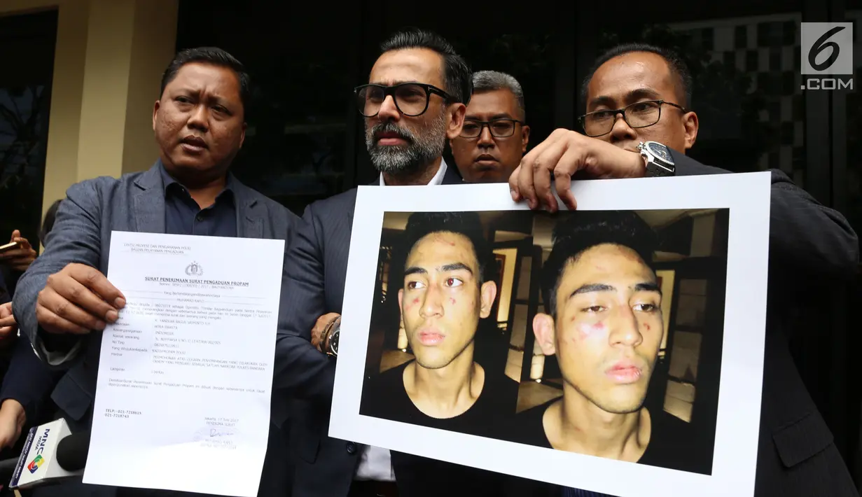 Aktor Jeremy Thomas menunjukkan foto luka yang dialami anaknya, Axel Matthew, di Divisi Propam Mabes Polri, Jakarta, Senin (17/7). Jeremy Thomas melaporkan orang yang diduga oknum polisi atas kekerasan yang dialami putranya. (Liputan6.com/Herman Zakharia)