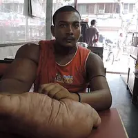 Bablu, lelaki asal India yang punya lengan seberat 20 kilogram. (NewsFlare)