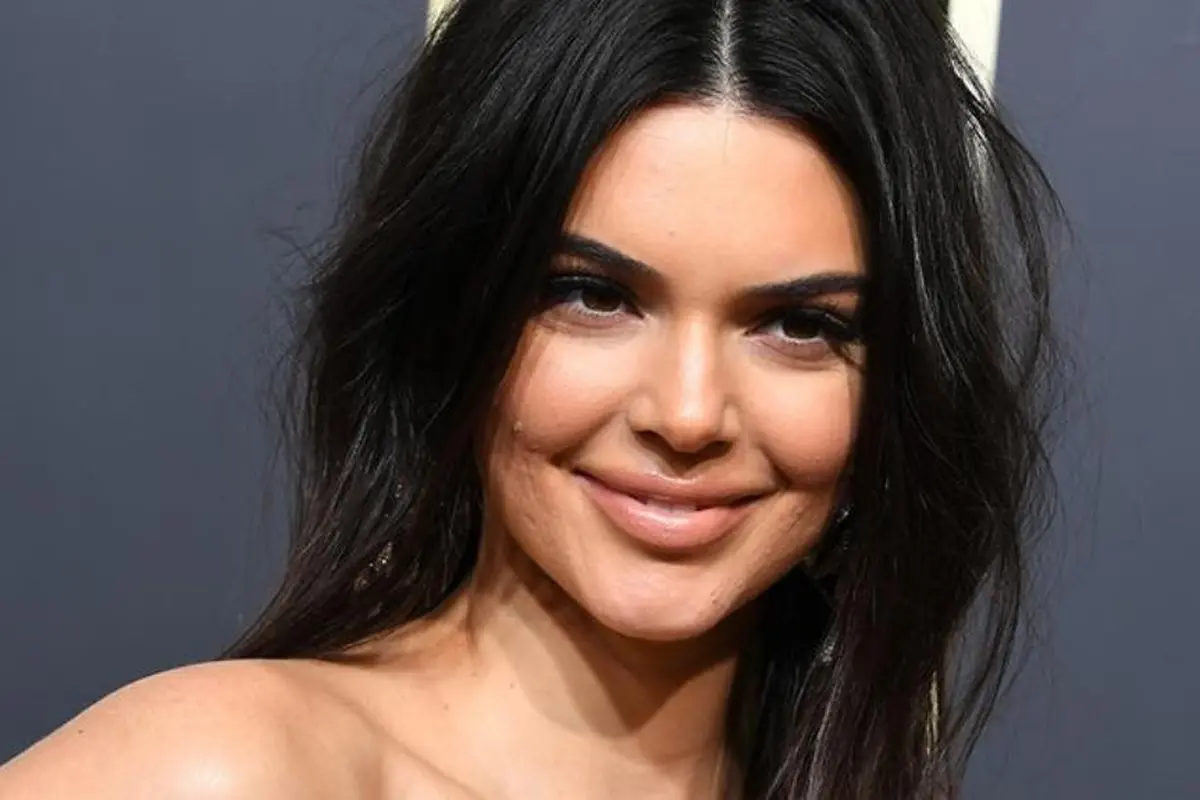 Nggak Mau Jerawatan Seperti Kendall Jenner? Atasi dengan Cara Ini