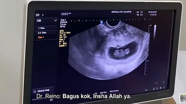 Mulai Rasakan Mual, Ini 6 Momen Zaskia Sungkar Cek USG Pertama Kali