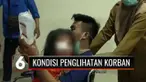 Begini penjelasan tim dokter usai operasi, terkait kondisi penglihatan bocah perempuan yang alami tindak kekerasan. Sementara itu, polisi telah menetapkan kedua orang tua korban menjadi tersangka.