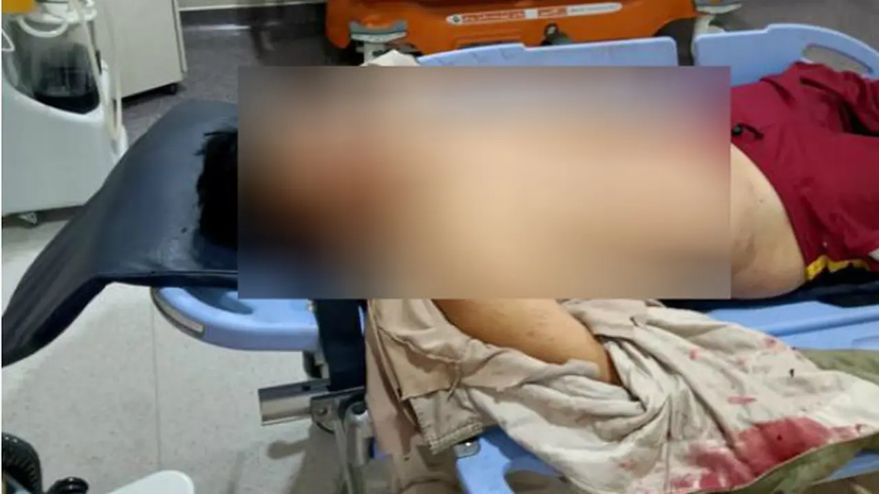 Kepala Sub Bagian (Kasubbag) Humas Polres Langkat, AKP Arnold Hasibuan, menjadi korban tabrak lari/Reza Efendi
