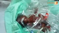 [VIDEO] Satu dari Bayi Kembar Lima Meninggal Lagi