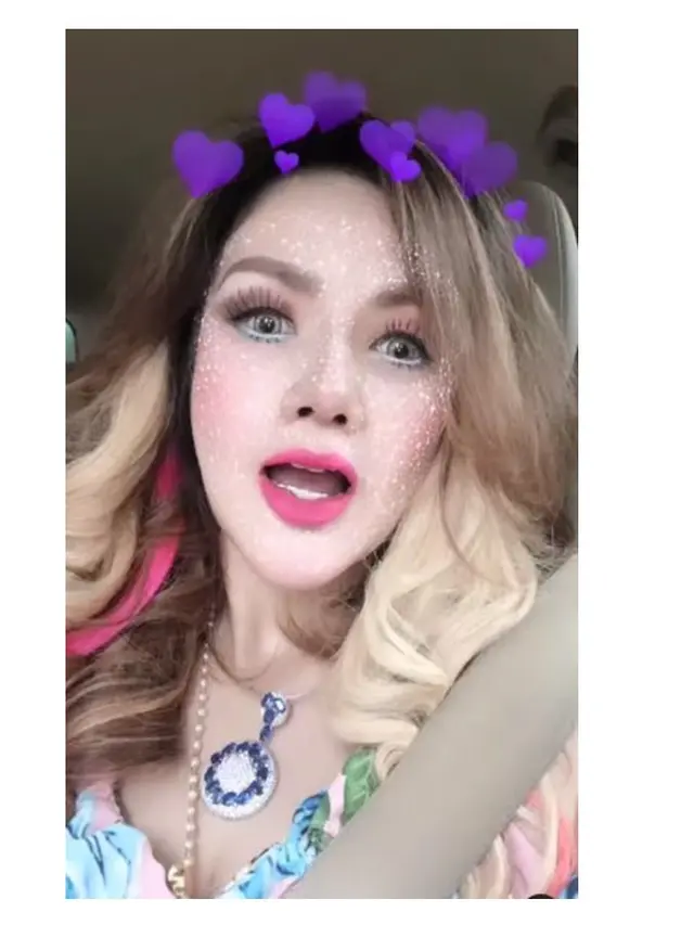 Makin Mancung, Ini 8 Potret Barbie Kumalasari Pasca Operasi Hidung Senilai Rp 50 Juta