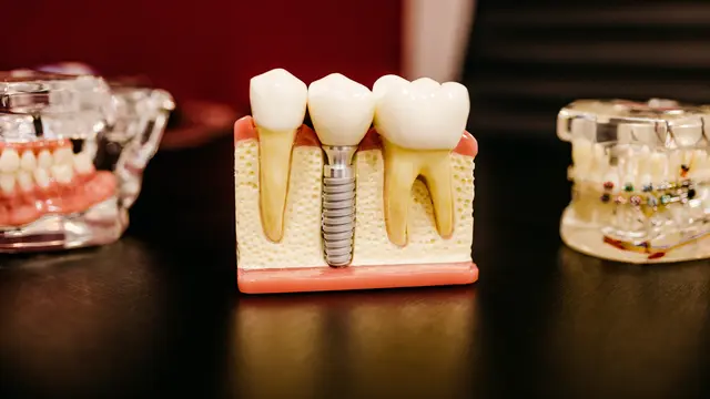 Langkah Teknik Mewing