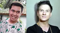 Sakit Parah, Olga Syahputra Sempat Curhat dengan Bertrand Antolin