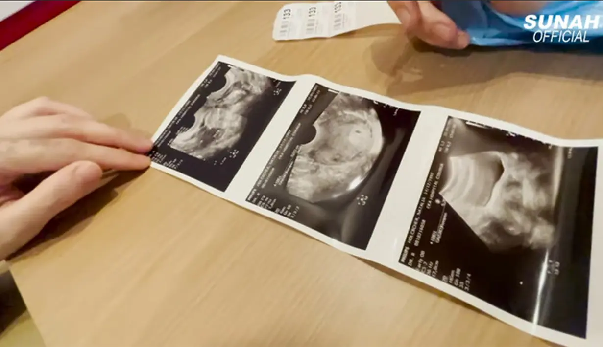 Nathalie Holscher (Youtube/Sunah Official)