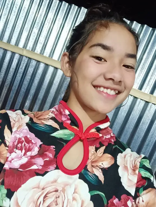 Chetryn yang memiliki gigi gingsul dan senyum nan indah membuat aura kecantikannya bertambah. (Liputan6.com/IG/@chetrynpeto)