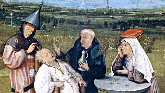 Ilustrasi trepanasi (Wikimedia Commons)