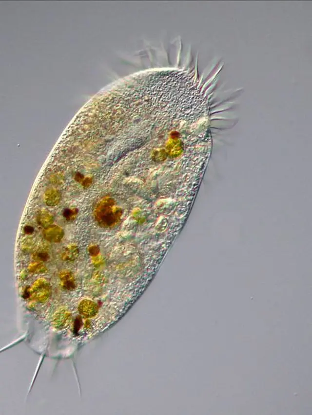 Amoeba dilihat dari mikroskop