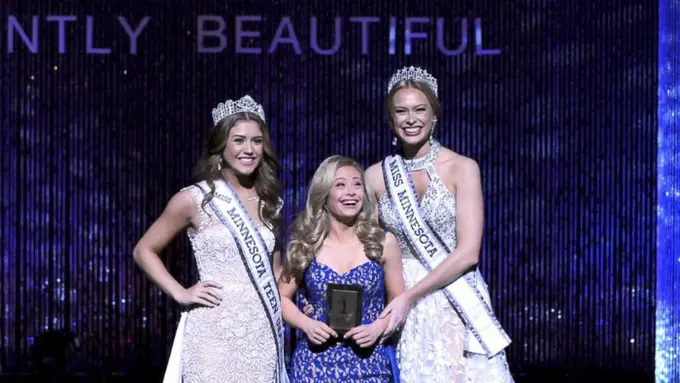 [Bintang] Down Syndrome