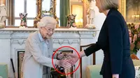 Ratu Elizabeth II sebelum meninggal bertemu dengan Liz Truss pada hari Selasa 6 September 2022. Tangannya terlihat biru dan ungu. (AP)