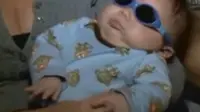 Bayi Ini Lahir Tanpa Bola Mata