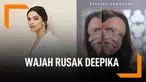 Deepika Padukone Tampil Dengan Wajah Rusak, Kenapa