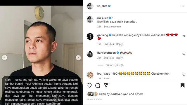 Rio Alief ceritakan perjuangan Clerence melawan kanker (Foto: Instagram rio_alief)