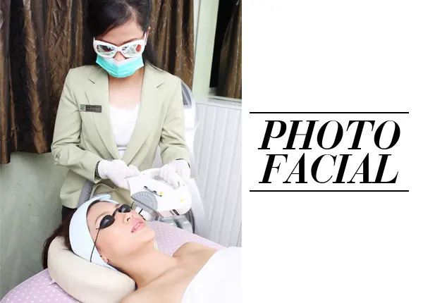 photo facial