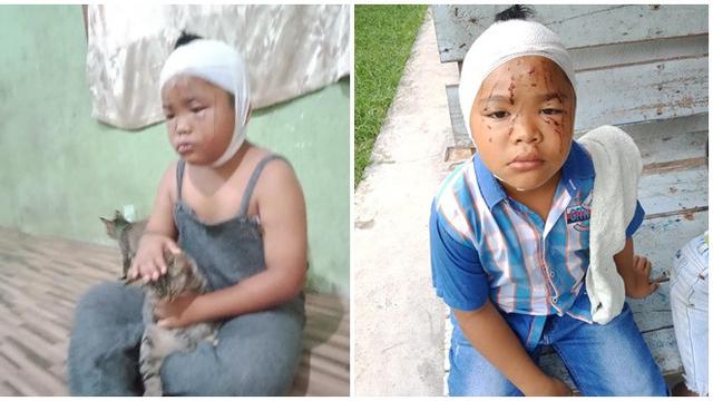 Wajahnya Sering Dicakar, Bocah Ini Tetap Rawat dan Sayang Kucingnya