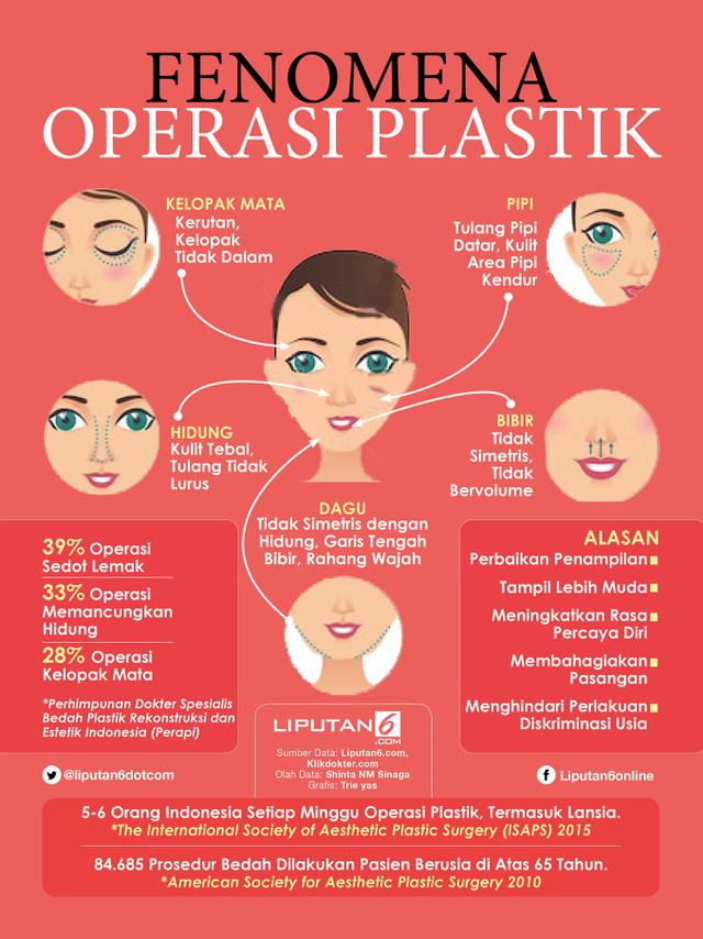 Infografis Fenomena Operasi Plastik (Liputan6.com/Triyasni)