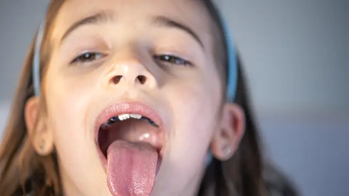 Seorang anak perempuan menjulurkan lidahnya keluar (Foto Dok: Freepik/pvproductions)