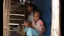 Amanah (10), bocah asal Mamuju, Sulawesi Barat, hidup tersisih karena kulitnya bersisik yang diduga akibat kelainan genetika. (Istimewa)