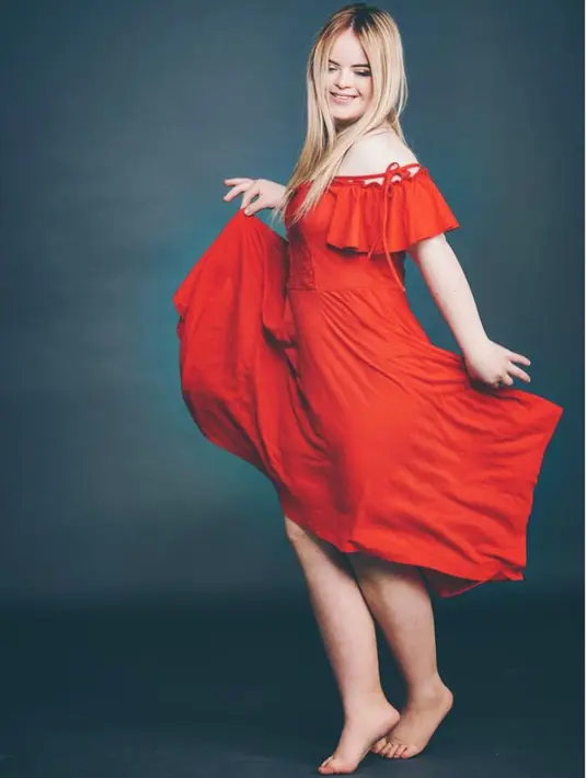 Kate Grant (19) menjadi penyandang Down Syndrome pertama yang memenangkan kontes kecantikan dunia, mengalahkan 40 kontestan lainnya dalam ajang Teen Ultimate Beauty of The World di Portadown. Kini, dirinya didapuk menjadi duta kosmetik ternama dunia, Benefit Cosmetics. (Instagram/@kategrantmodel)