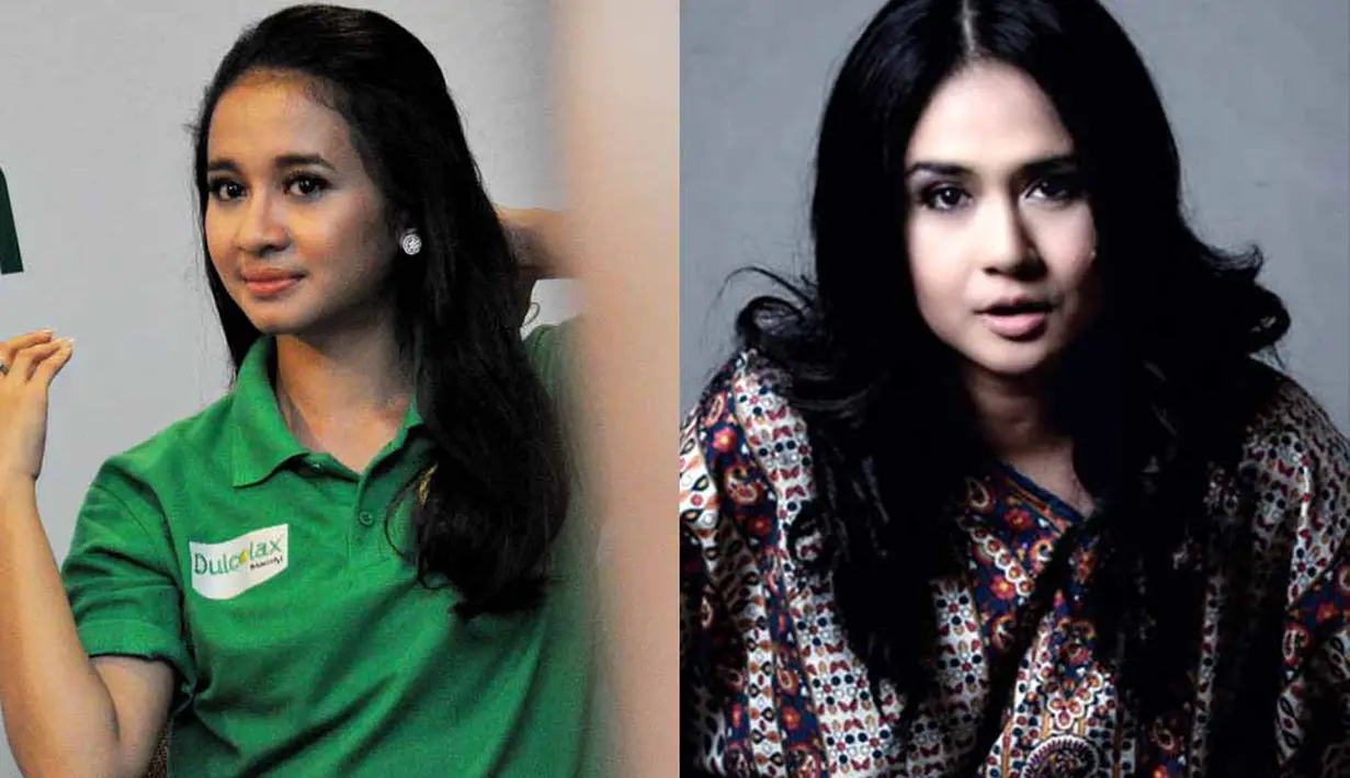 Senyum manis yang mengembang dan deretan gigi putih yang tersusun rapi. Bisa dikatakan keduanya nyaris memiliki kemiripan (Foto-foto:Liputan6.com,Istimewa)