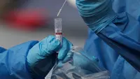 Beberapa lembaga kesehatan, termasuk CDC dan WHO, telah memantau gelombang baru Virus Corona COVID-19 Varian BA.2.86. (Arnulfo Franco/AP)