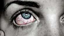 Ilustrasi mata merah. Image by agnesliinnea from Pixabay