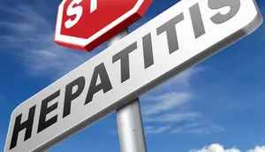 Begini Cara Mencegah Hepatitis A, B, dan C