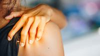 Ilustrasi frozen shoulder, kekakuan pada bahu atau bahu kaku/Shutterstock-anut21ng Stock.