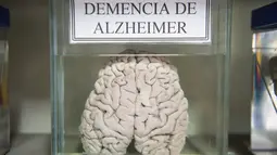 Salah satu otak manusia yang diawetkan di Museum Neuropatologi, di Rumah Sakit Santo Toribio de Mogrovejo, Lima, Peru (16/11). Neuroptologi adalah adalah sebuah subspesialisasi patologi yang berhubungan dengan penyakit otak. (AFP Photo/Ernesto Benavides)