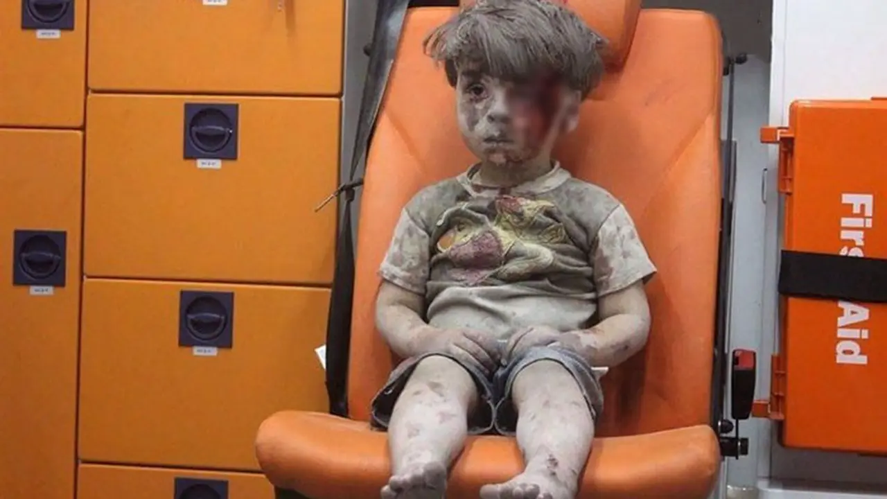 Alami Pendarahan Internal, Kakak Omran Tewas di Aleppo