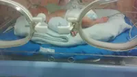 Keempat bayi kembar berinisial LOVE itu masih menjalani perawatan di ruang NICU RSUD dr Soetomo Surabaya. (Liputan6.com/Dhimas Prasaja)