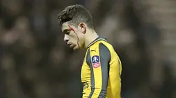 Pemain Arsenal, Gabriel terlihat berdarah saat berbenturan dengan pemain Preston North End pada laga Piala FA diDeepdale, Preston, (7/1/2017). Arsenal menang 2-1. (Dave Howarth/PA via AP)