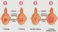 6 Fakta Menarik tentang Selaput Dara
