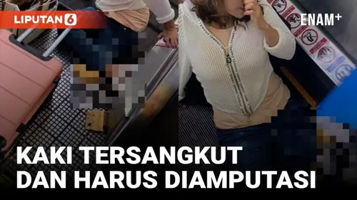 VIDEO: Wanita Ini Harus Rela Kakinya Diamputasi Akibat Tersangkut di Travelator Bandara Thailand