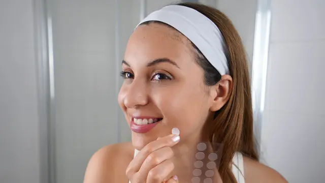 Acne Patch Lagi Populer untuk Meredakan Jerawat, Seberapa Efektif Sih Penggunaannya?